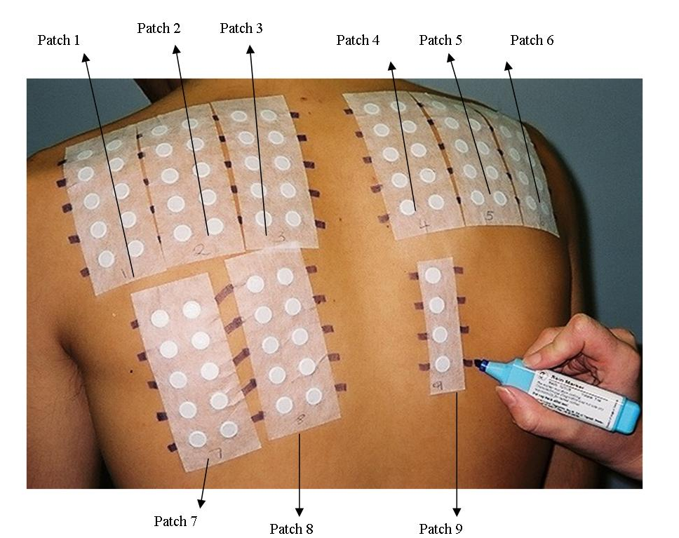 A person's back with patches on their back Description automatically generated with low confidence